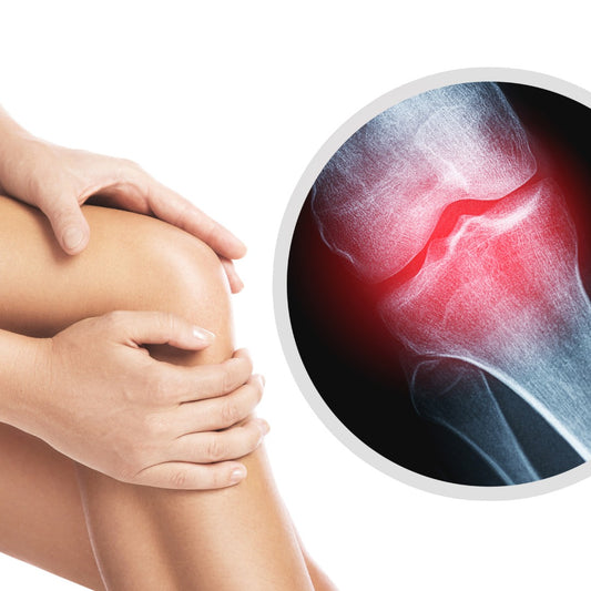 Discover the Power of Red Light Therapy for Joint Health